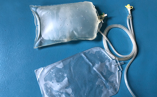 Peritoneum Dialysis Series